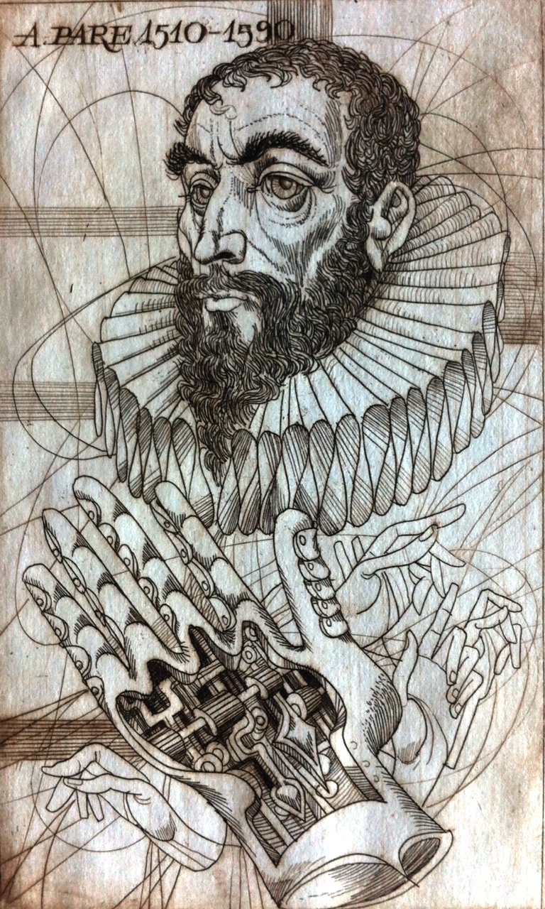 Kass János: Orvosportrék - Pare 1510-1590